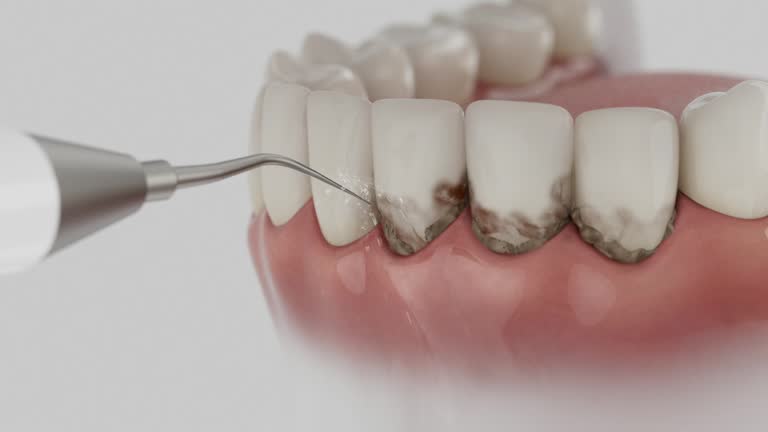 Reliable Emergency Dentist contractor in Big Rapids, MI by Smile Center Dentistry